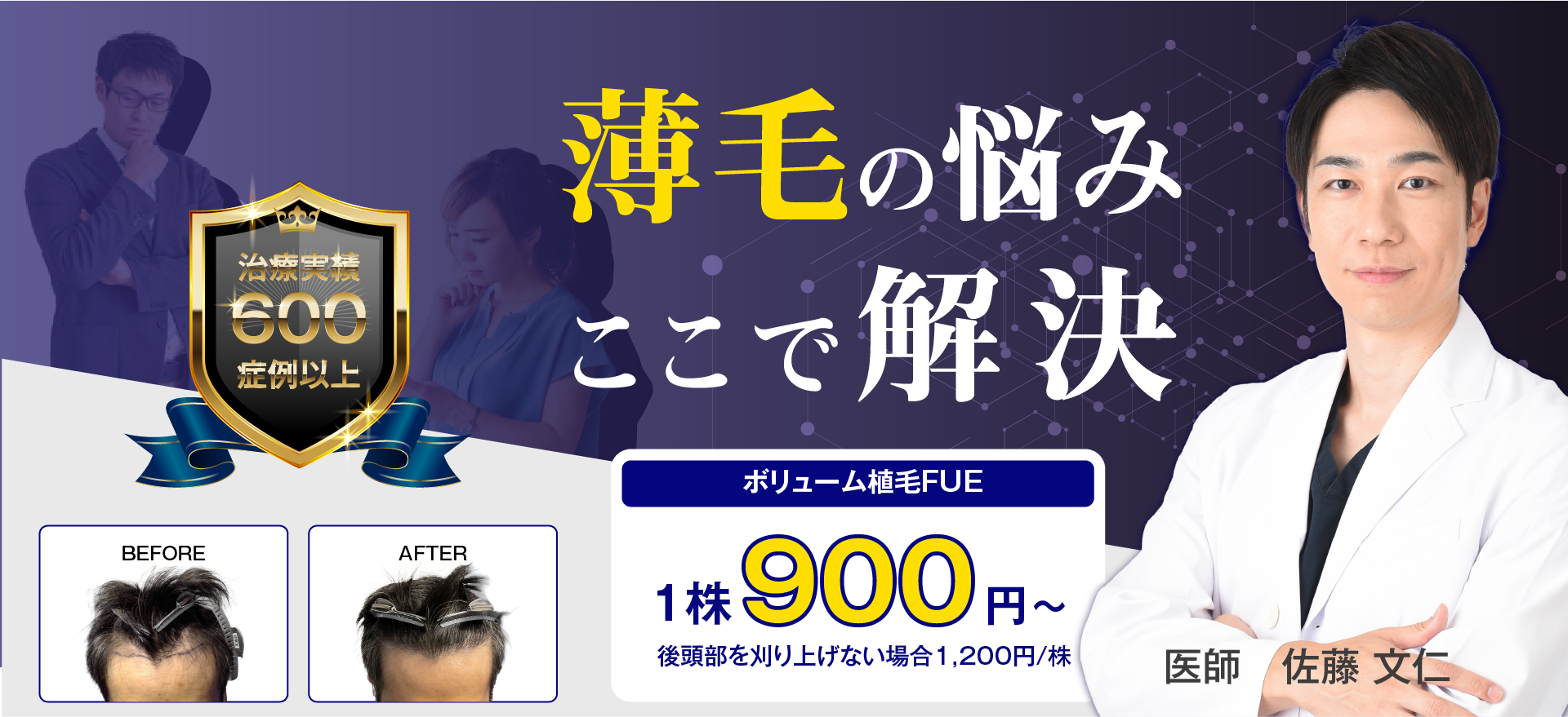 治療実績600症例以上 薄毛のお悩みここで解決 飲み薬や付け薬で効果がなかった方 当院の先進的な植毛手術で解決しましょう。ボリューム植毛FUE 1株900円〜 後頭部を刈り上げない場合 1,200円/株