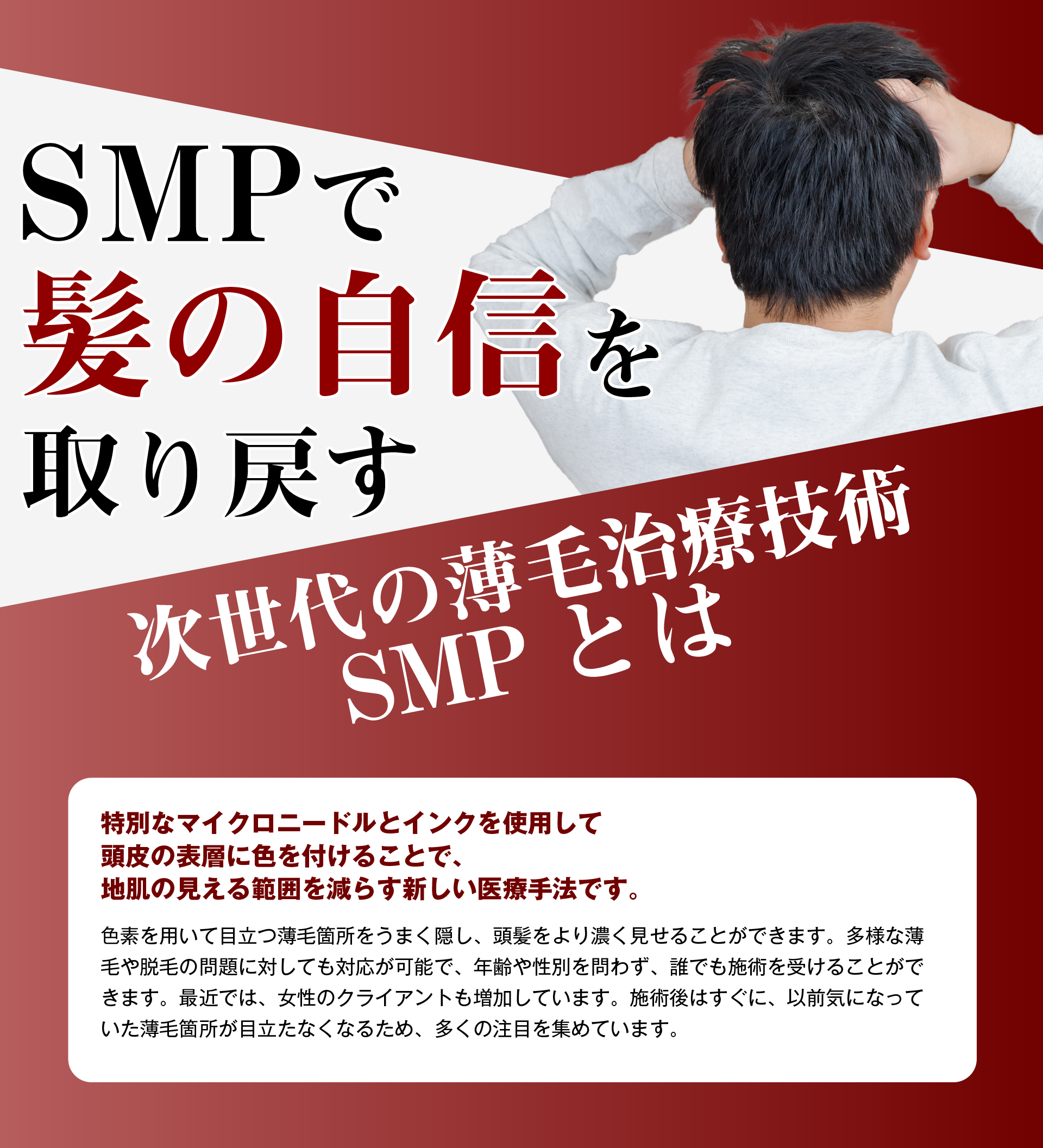 SMPで髪の自信を取り戻す　次世代の薄毛治療技術SMPとは特別なマイクロニードルとインクを使用して頭皮の表層に色を付けることで、地肌の見える範囲を減らす新しい医療手法です。