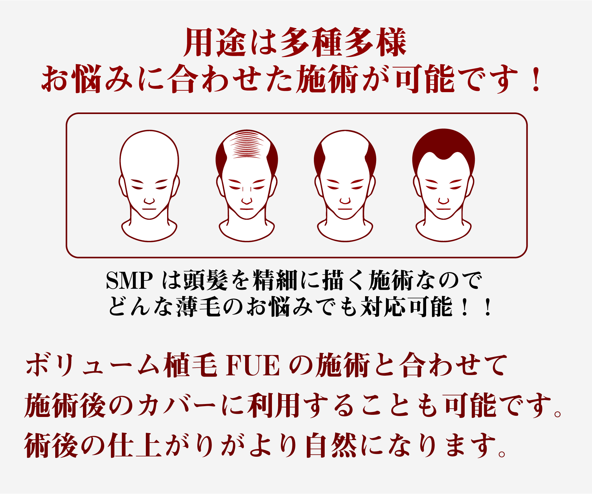 用途は多種多様、お悩みに合わせた施術が可能です！！ボリューム植毛FUE施術と合わせて施術後のカバーに利用することも可能です。
