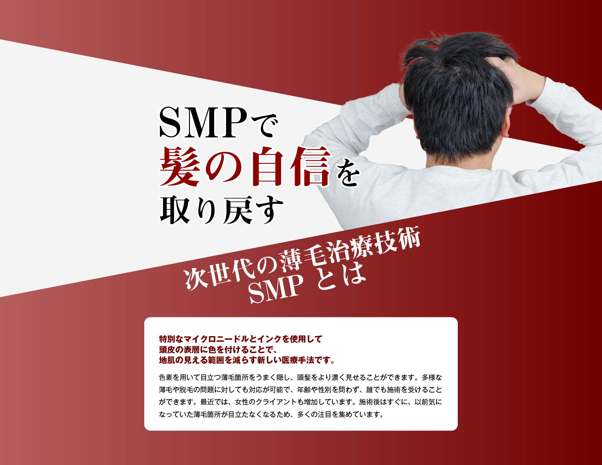 SMPで髪の自信を取り戻す　次世代の薄毛治療技術SMPとは特別なマイクロニードルとインクを使用して頭皮の表層に色を付けることで、地肌の見える範囲を減らす新しい医療手法です。